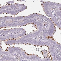 Invitrogen TMEM237 Polyclonal Antibody 100 &mu;L; Unconjugated:Antibodies,