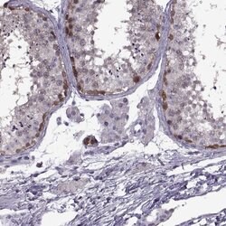 Invitrogen PAGE2B Polyclonal Antibody 100 &mu;L; Unconjugated:Antibodies,