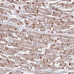 JPH2 Polyclonal Antibody:Antibodies, Polyclonal