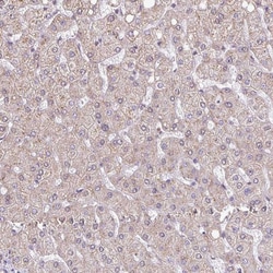 JPH2 Polyclonal Antibody:Antibodies, Polyclonal