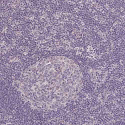 JPH2 Polyclonal Antibody:Antibodies, Polyclonal