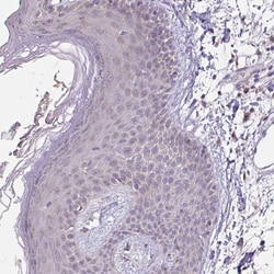 JPH2 Polyclonal Antibody:Antibodies, Polyclonal
