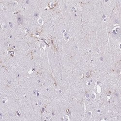 Invitrogen TMEM119 Polyclonal Antibody 100 &mu;L; Unconjugated:Anticuerpos