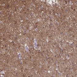 Invitrogen PRRT4 Polyclonal Antibody 100 &mu;L; Unconjugated:Antibodies,