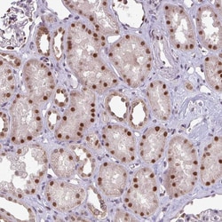 C19orf39 Polyclonal Antibody:Antibodies, Polyclonal