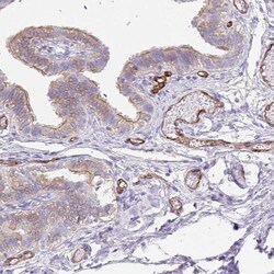 Invitrogen EHD4 Polyclonal Antibody 100 &mu;L; Unconjugated:Antibodies,