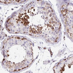 Invitrogen EHD4 Polyclonal Antibody 100 &mu;L; Unconjugated:Antibodies,