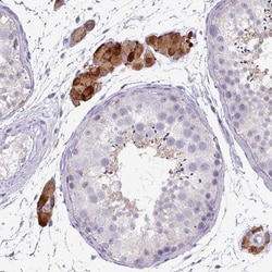 Invitrogen ZNF878 Polyclonal Antibody 100 &mu;L; Unconjugated:Antibodies,