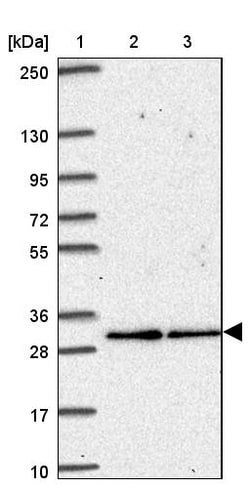 Invitrogen V-ATPase E2 Polyclonal Antibody 100 &mu;L | Buy Online | Invitrogen&trade; | Fisher Scientific