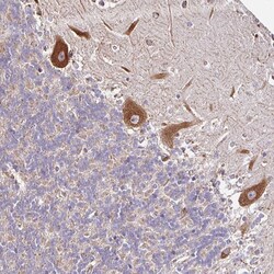 Invitrogen Carboxypeptidase D Polyclonal Antibody 100 &mu;L | Buy Online | Invitrogen&trade; | Fisher Scientific