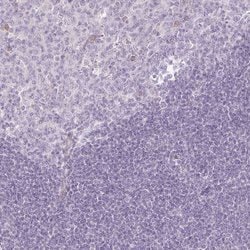 Invitrogen PAQR9 Polyclonal Antibody 100 &mu;L; Unconjugated:Antibodies,