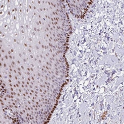 Invitrogen TMEM215 Polyclonal Antibody 100 &mu;L; Unconjugated:Antibodies,