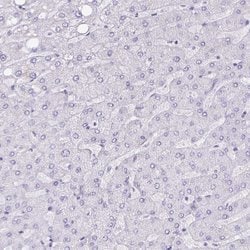 NCCRP1 Polyclonal Antibody 100 &mu;L | Buy Online | Thermo Scientific | Fisher Scientific