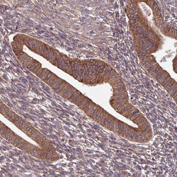 Invitrogen FAT4 Polyclonal Antibody 100 &mu;L; Unconjugated:Antibodies,