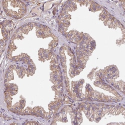 Invitrogen FAT4 Polyclonal Antibody 100 &mu;L; Unconjugated:Antibodies,