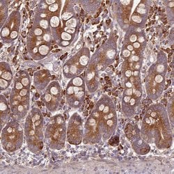 Invitrogen FAT4 Polyclonal Antibody 100 &mu;L; Unconjugated:Antibodies,