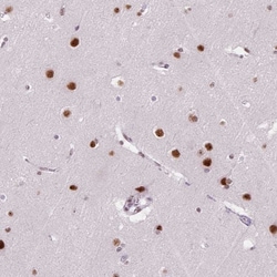 Invitrogen C2orf82 Polyclonal Antibody 100 &mu;L; Unconjugated:Antibodies,