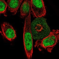 Invitrogen C2orf82 Polyclonal Antibody 100 &mu;L; Unconjugated:Antibodies,