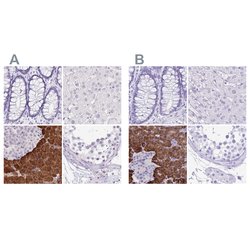 Invitrogen ERP27 Polyclonal Antibody 100 &mu;L; Unconjugated:Antibodies,