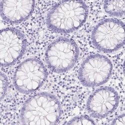 Invitrogen ERP27 Polyclonal Antibody 100 &mu;L; Unconjugated:Antibodies,