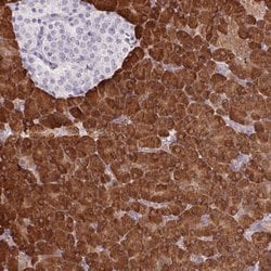Invitrogen ERP27 Polyclonal Antibody 100 &mu;L; Unconjugated:Antibodies,