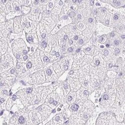 Invitrogen ERP27 Polyclonal Antibody 100 &mu;L; Unconjugated:Antibodies,