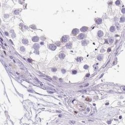 Invitrogen ERP27 Polyclonal Antibody 100 &mu;L; Unconjugated:Antibodies,