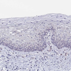 Invitrogen GLDC Polyclonal Antibody 100 &mu;L; Unconjugated:Antibodies,