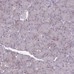 Invitrogen GLDC Polyclonal Antibody 100 &mu;L; Unconjugated:Antibodies,