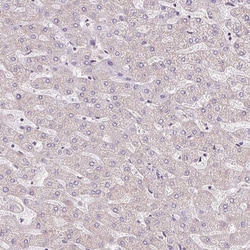 Invitrogen ATP8A1 Polyclonal Antibody 100 &mu;L; Unconjugated:Antibodies,