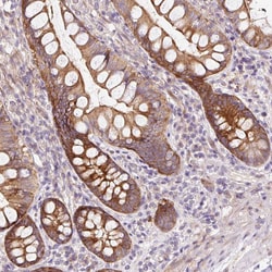 Invitrogen ATP8A1 Polyclonal Antibody 100 &mu;L; Unconjugated:Antibodies,