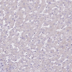 Invitrogen COL17A1 Polyclonal Antibody 100 &mu;L | Buy Online | Invitrogen&trade; | Fisher Scientific