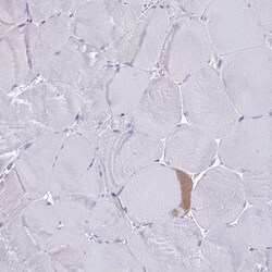 Invitrogen COL17A1 Polyclonal Antibody 100 &mu;L | Buy Online | Invitrogen&trade; | Fisher Scientific