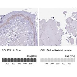 Invitrogen COL17A1 Polyclonal Antibody 100 &mu;L | Buy Online | Invitrogen&trade; | Fisher Scientific