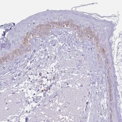 Invitrogen COL17A1 Polyclonal Antibody 100 &mu;L | Buy Online | Invitrogen&trade; | Fisher Scientific