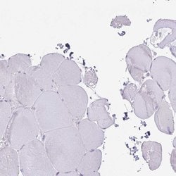 Invitrogen COL17A1 Polyclonal Antibody 100 &mu;L | Buy Online | Invitrogen&trade; | Fisher Scientific