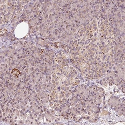 Invitrogen ZNF460 Polyclonal Antibody 100 &mu;L; Unconjugated:Antibodies,