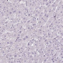 Invitrogen C9orf24 Polyclonal Antibody 100 &mu;L | Buy Online | Invitrogen&trade; | Fisher Scientific