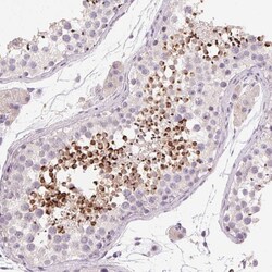 Invitrogen LYZL6 Polyclonal Antibody 100 &mu;L; Unconjugated:Antibodies,