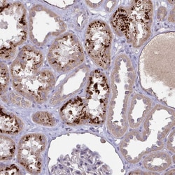 Invitrogen ORP7 Polyclonal Antibody 100 &mu;L; Unconjugated:Antibodies,