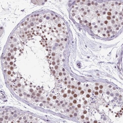 Invitrogen ZFP3 Polyclonal Antibody 100 &mu;L; Unconjugated:Antibodies,