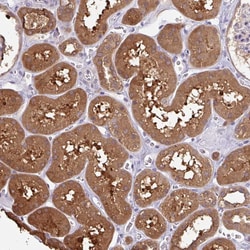 OTOP2 Polyclonal Antibody 100 &mu;L | Buy Online | Thermo Scientific | Fisher Scientific