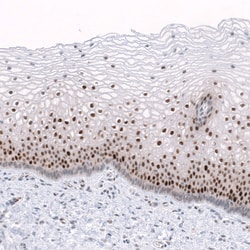 Invitrogen TRIP13 Polyclonal Antibody 100 &mu;L; Unconjugated:Antibodies,