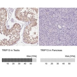 Invitrogen TRIP13 Polyclonal Antibody 100 &mu;L; Unconjugated:Antibodies,
