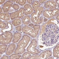 Invitrogen TSEN54 Polyclonal Antibody 100 &mu;L; Unconjugated:Antibodies,