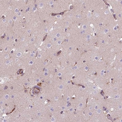 Invitrogen COL8A1 Polyclonal Antibody 100 &mu;L; Unconjugated:Antibodies,
