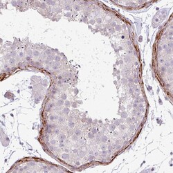 Invitrogen COL8A1 Polyclonal Antibody 100 &mu;L; Unconjugated:Antibodies,