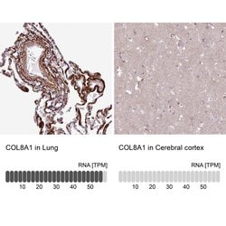 Invitrogen COL8A1 Polyclonal Antibody 100 &mu;L; Unconjugated:Antibodies,