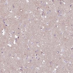 Invitrogen COL8A1 Polyclonal Antibody 100 &mu;L; Unconjugated:Antibodies,