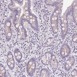 Invitrogen AdoHcyase 3 Polyclonal Antibody 100 &mu;L; Unconjugated:Antibodies,